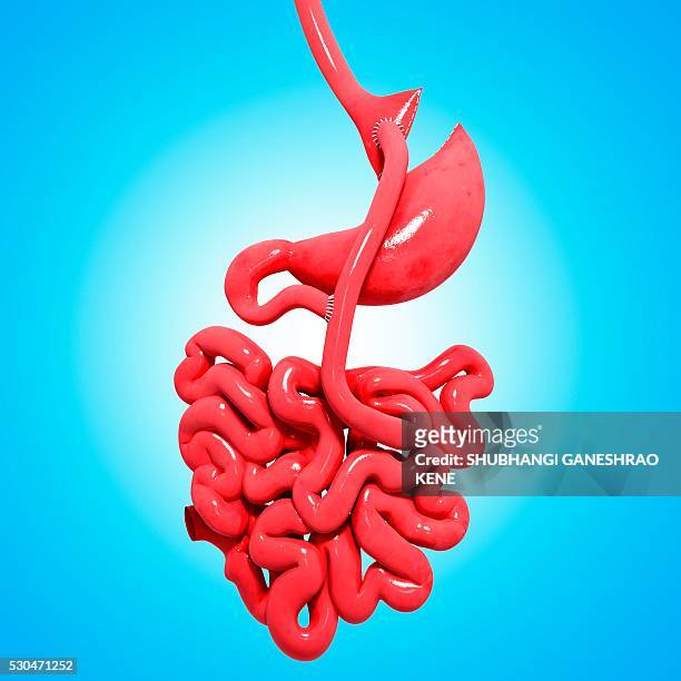 gastric bypass, computer artwork. - oesophagus stock pictures, royalty-free photos & images