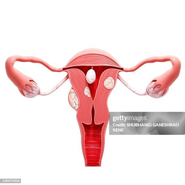 uterine cancer, computer artwork. - ovarios fotografías e imágenes de stock