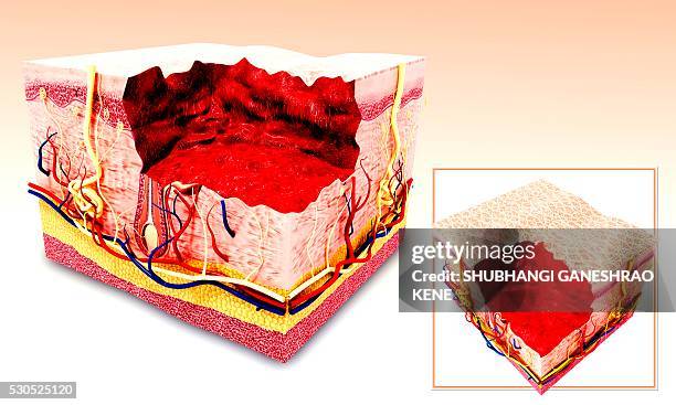 human skin anatomy, computer artwork. - lederhuid stockfoto's en -beelden