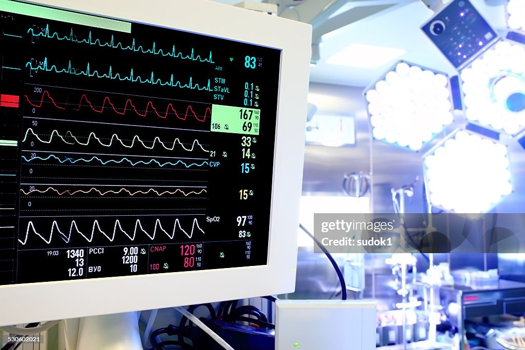 Medical monitor in the operating room.