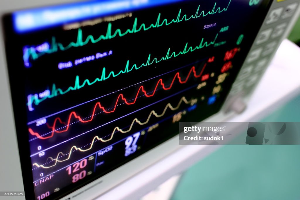 Medical background. Monitor with varicolored schedules (curves)