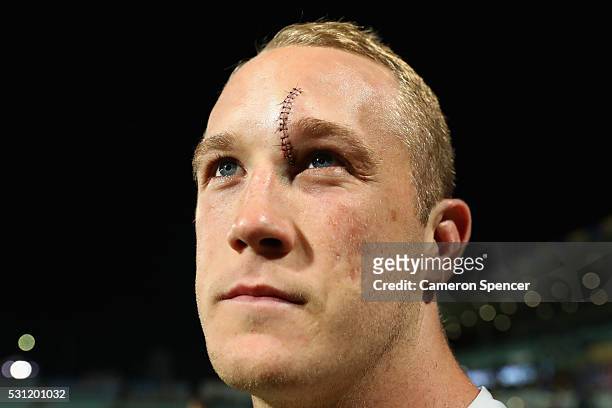 Jason Clark of the Rabbitohs looks on with stitches in his head following the round 10 NRL match between the Parramatta Eels and the South Sydney...