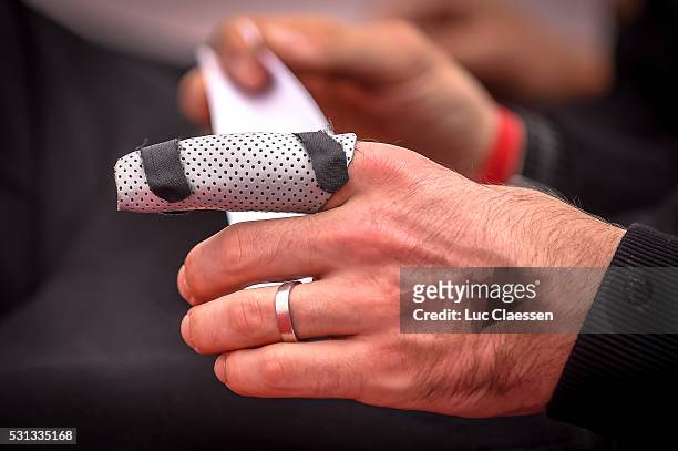 Team Giant Alpecin / Press Conference DEGENKOLB John / Injury Blessure Finger Vinger / PC / Paris - Roubaix Parijs /