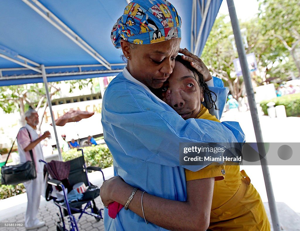 Ten years ago, she had 16-pound facial tumor removed