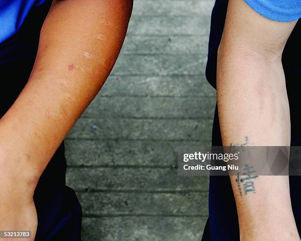 Asian Injection Mark Kunming Municipal Compulsory Rehabilitation Center Photos and Premium ...