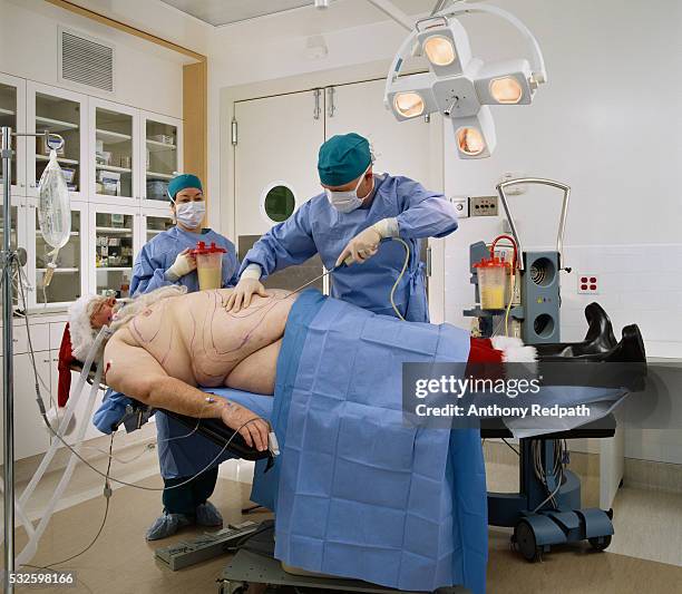 santa getting liposuction - doctor humor stock pictures, royalty-free photos & images