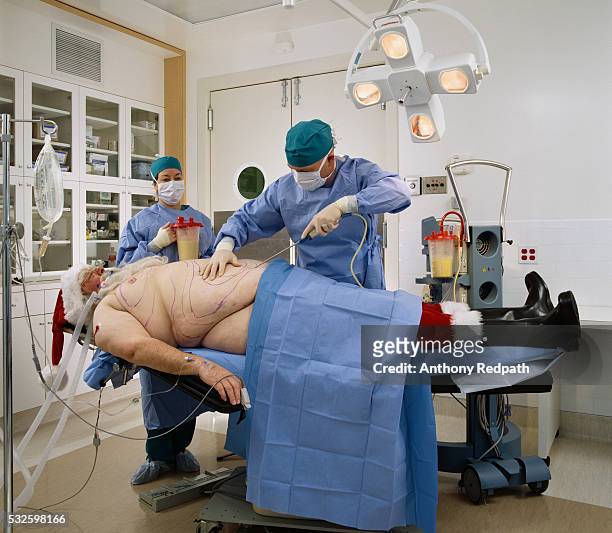 santa getting liposuction - fat woman funny imagens e fotografias de stock