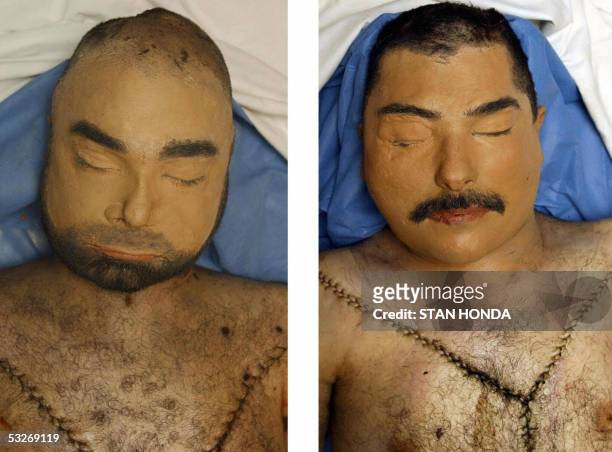-This combo of pictures dated 25 July 2003 shows corpses said to be of former Iraqi dictator Saddam Hussein's sons Uday and Qusay, who US forces...