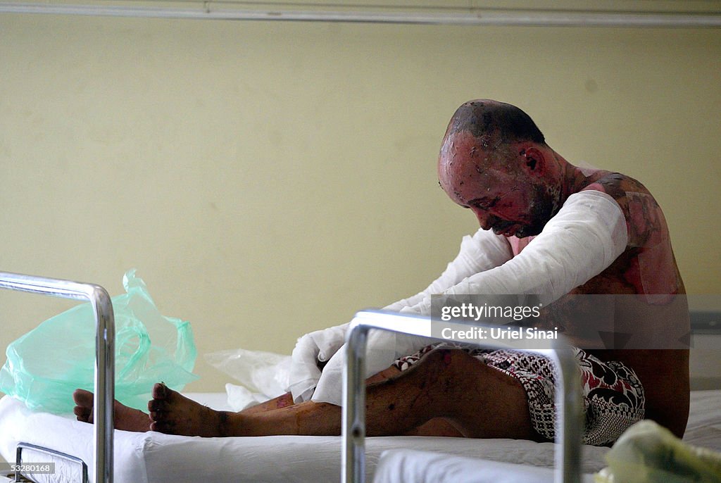 Victims Recover After Egyptian Resort Bombing