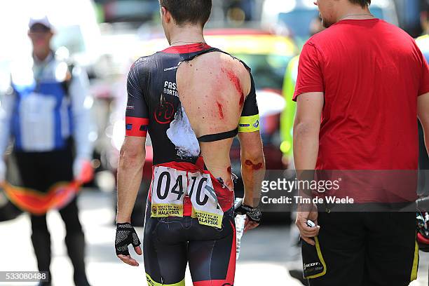 21th Tour Langkawi 2015/ Stage 2 PAGE Dylan / Injure/ Sungai Petani - Georgetown / Ronde etape rit/ Malaysia/ Tim De Waele