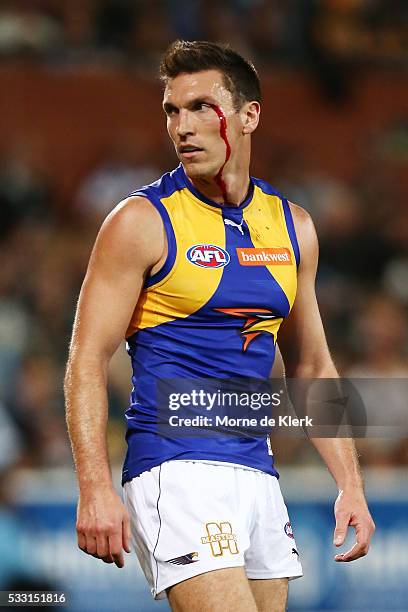 Sam Butler of the Eagles looks on as blood runs from his eye during the round nine AFL match between the Port Adelaide Power and the West Coast...