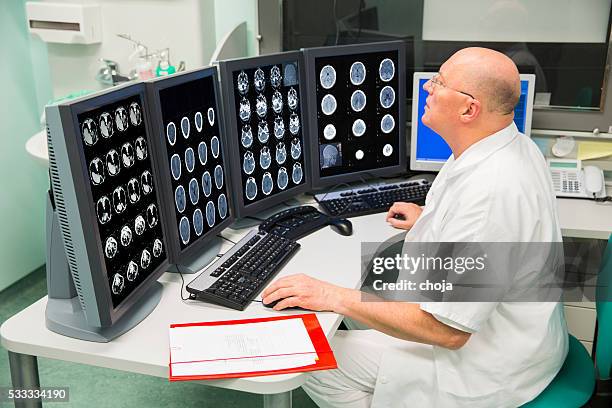 senior radiologist of oncology institute is examing mri scans - tomography stock pictures, royalty-free photos & images