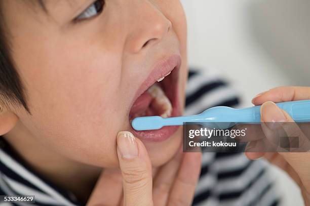 clean mouth - vesicular stomatitis stock pictures, royalty-free photos & images