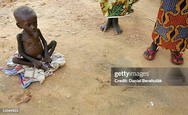 Malnourished young Nigerois boy waits for his mother to bathe him whilst receiving shelter and care at an MSF Medical Clinic on August 6, 2005 in...