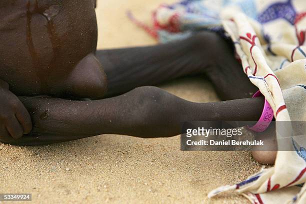 The figure of a malnourished Nigerois boy is seen as he waits for his mother to bathe him whilst receiving shelter and care at an MSF Medical Clinic...