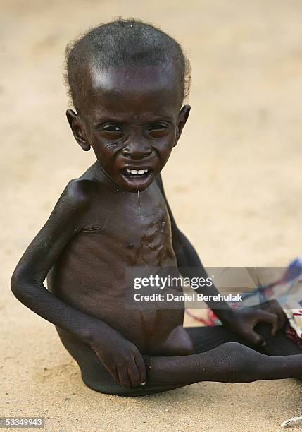 Malnourished young Nigerois boy waits for his mother to bathe him whilst receiving shelter and care at an MSF Medical Clinic on August 6, 2005 in...