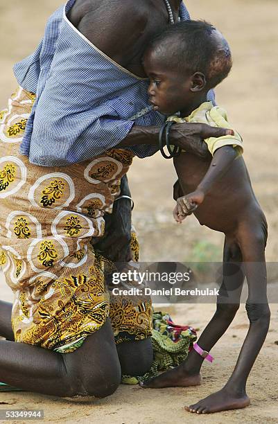 Malnourished young Nigerois boy is helped to his his feet by his mother whilst receiving shelter and care at an Medecins Sans Frontier Medical Clinic...