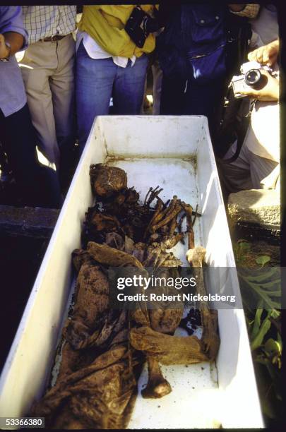 Exhumed pile of bones and remains purportedly belonging to Nazi war criminal Josef Mengele.