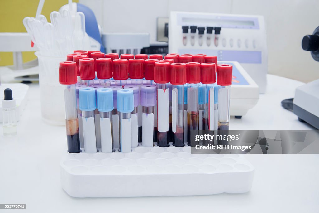 Close up of blood samples in test tube rack in laboratory