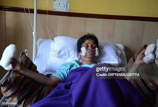 Indian mountaineer Chetna Sahoo receives treatment for frostbite at hospital in Siliguri on May 24 after a successful ascent of Mount Everest....