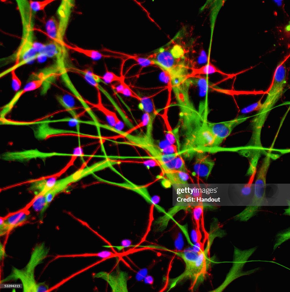 Stem Cells Open Doors To Greater Understanding Of Neurlogical Diseases