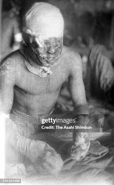 Japanese soldier exposed the atomic bomb receives a medical treatment at Fukuya Department store in August 1945 in Hiroshima, Japan. The world's...