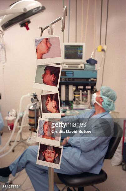 Pictures of facial parts where Dr. Dennis Nigro will perform reconstructive surgery for children who suffer from birth defects and other operable...