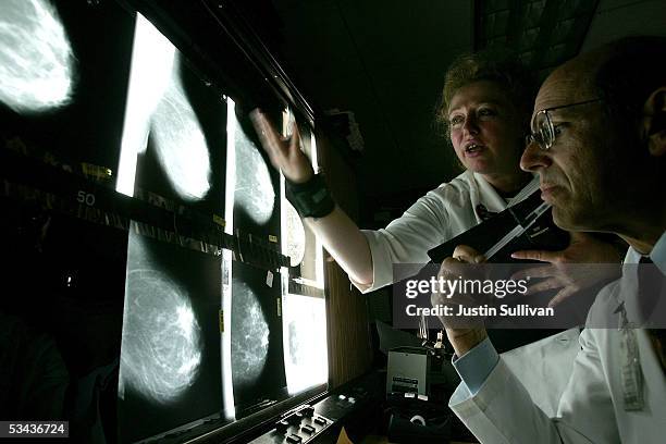 Dr. Edward Sickles MD and Larisa Gurilnik RT look at films of breast x-rays at the UCSF Comprehensive Cancer Center August 18, 2005 in San Francisco,...