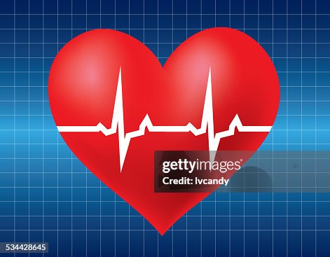 Electrocardiogram Electrocardiogram