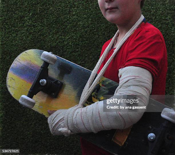 broken arm - broken skateboard stockfoto's en -beelden