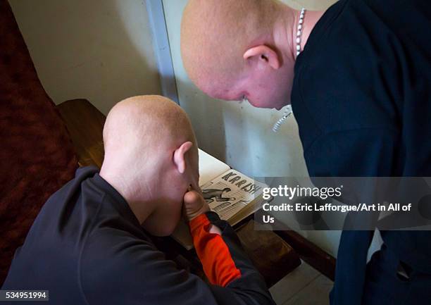 Tanzania, East Africa, Dar es Salaam, emmanuel festo a boy with albinism at under the same sun house, his left arm was hacked off above the elbow, he...