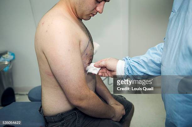 Matt Anderson is a student in New York. He underwent gynecomastia surgery in 2005 at a cost of $6,000. Here shortly after his operation with Dr Blau:...