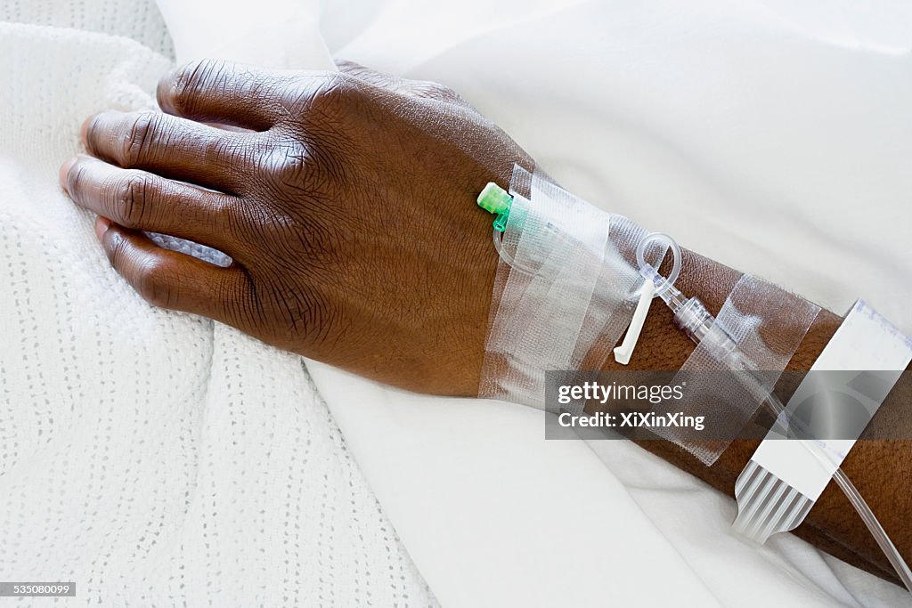 Arm of patient with drip