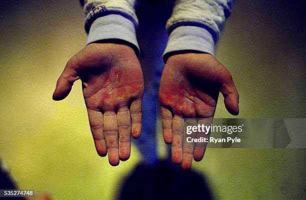 Pan Yi Chao, 8 years old, looks at his hands after training at the Li Xiaoshuang Gymnastics School in Xiantao, China. Li Xiaoshuang was a sucessful...