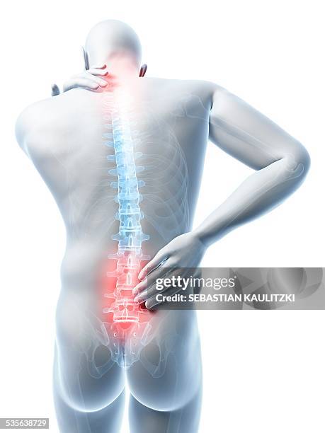 Back Problems Skeleton 253 Lower Back Skeleton Stock Photos, High-Res Pictures, and Images ...