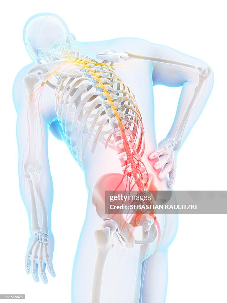 Human back pain, artwork