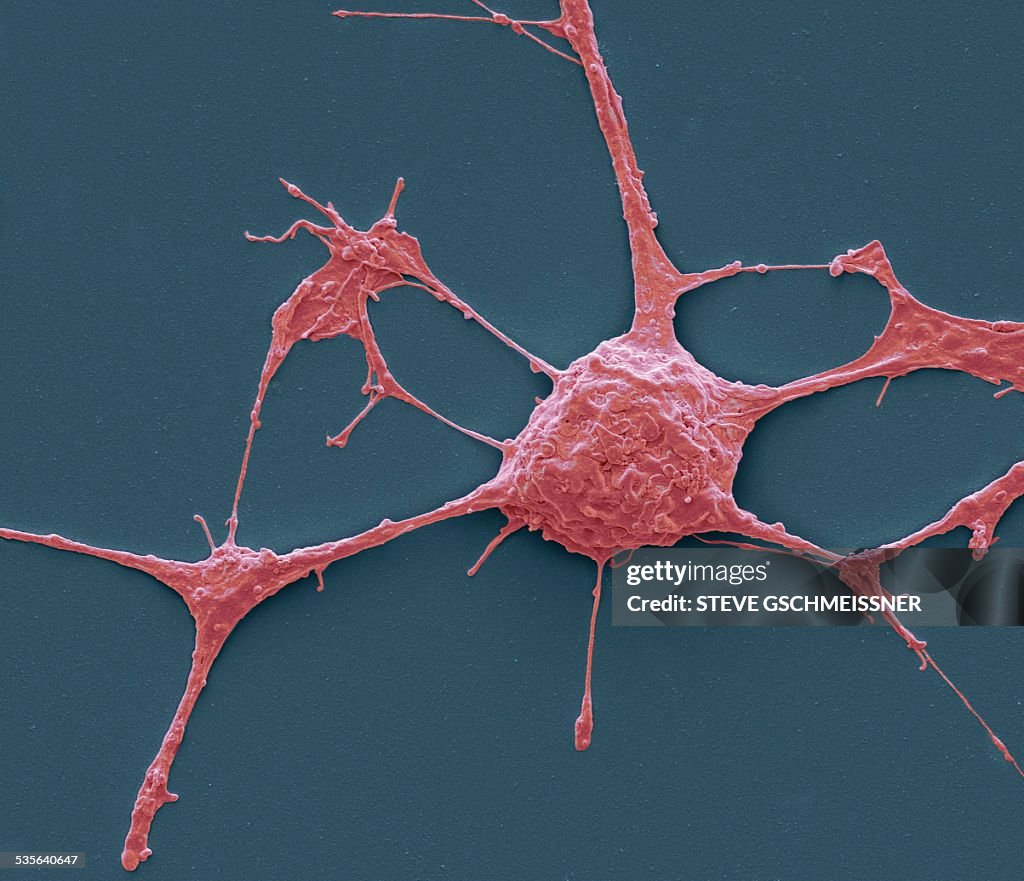 Neurone, SEM