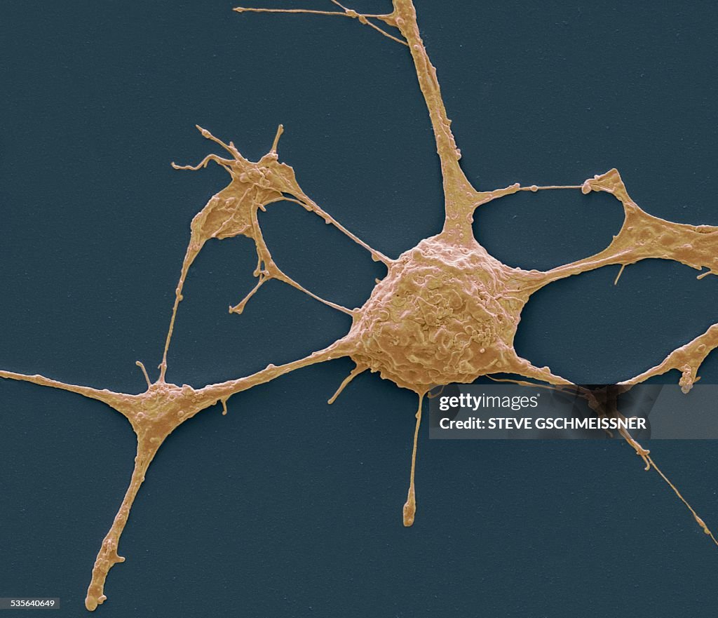 Neurone, SEM