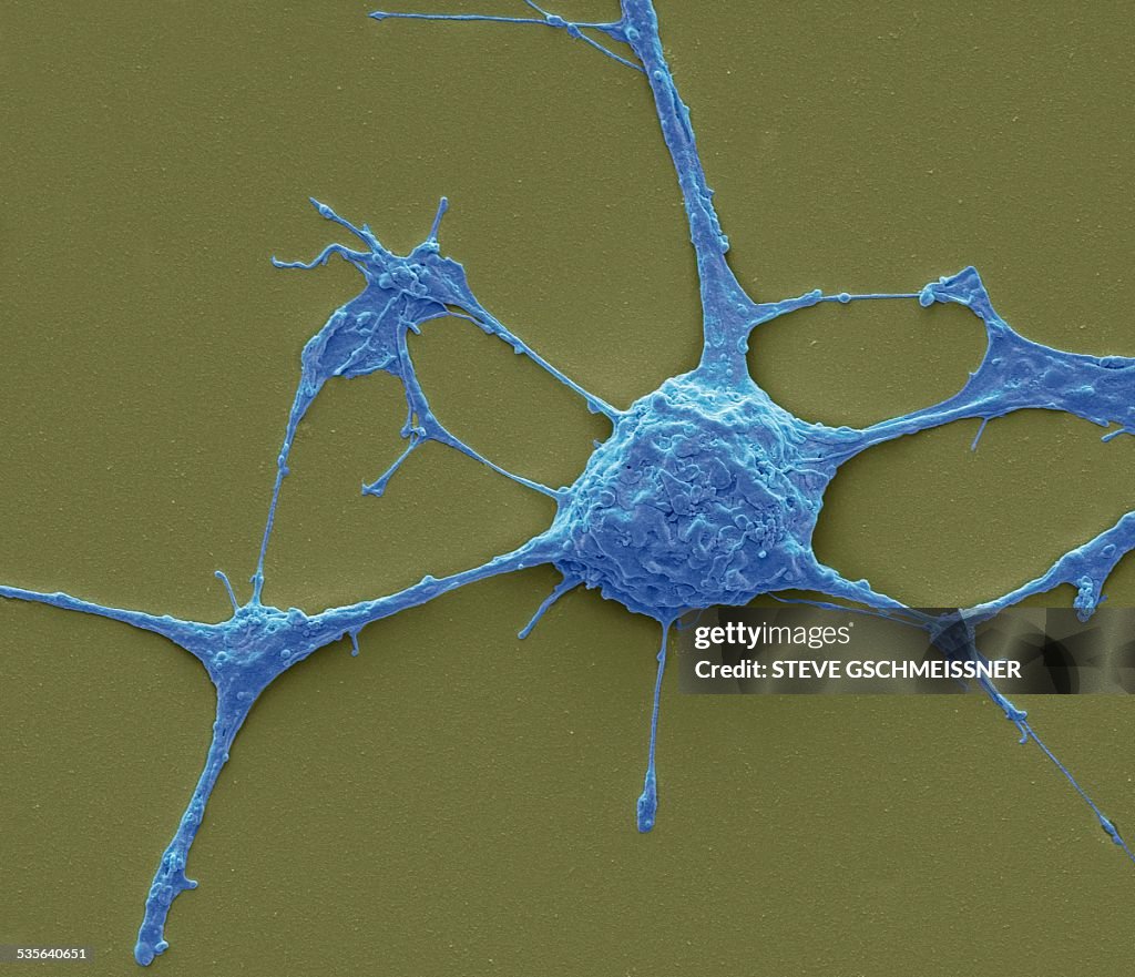 Neurone, SEM