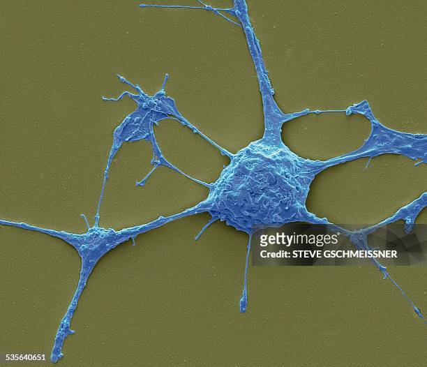 neurone, sem - scanning electron micrograph stock pictures, royalty-free photos & images