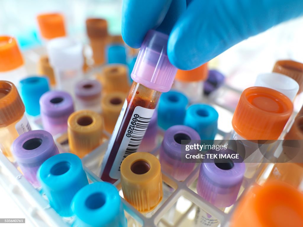 Person selecting a blood sample