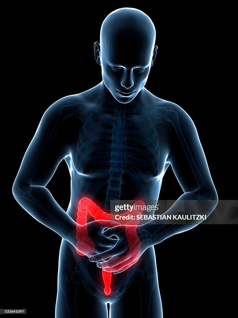 Human large intestine pain, illustration