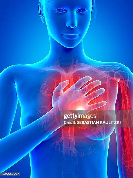 human heart attack, illustration - heart attack stock illustrations