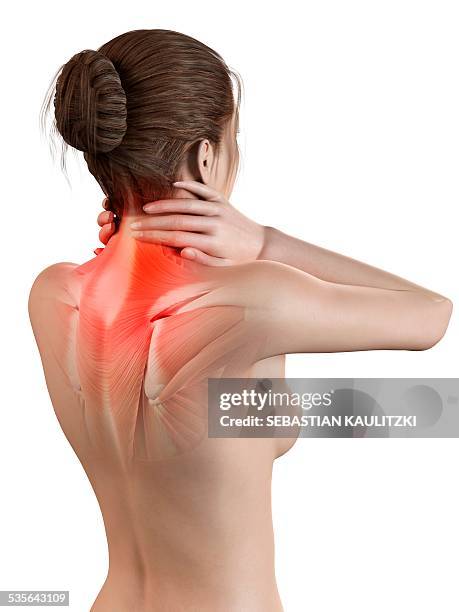 human neck pain, illustration - neck muscle pain illustration stock illustrations