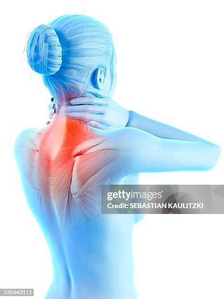 human neck pain, illustration - neck muscle pain illustration stock illustrations