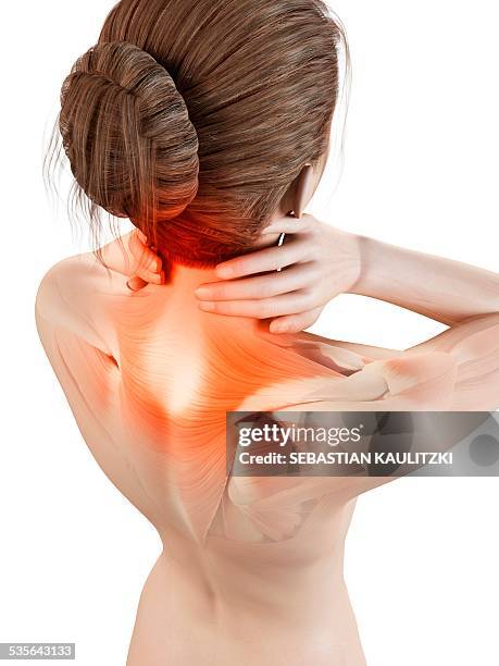 human neck pain, illustration - neck muscle pain illustration stock illustrations