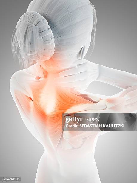 human neck pain, illustration - neck muscle pain illustration stock illustrations