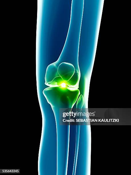 human knee joint, illustration - menschliches gelenk stock-grafiken, -clipart, -cartoons und -symbole