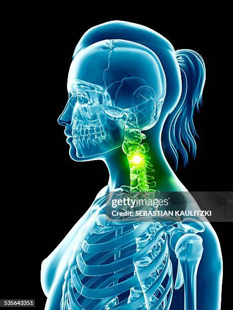 Neck Rotation Involven Bone Human Neck Bones Illustration High-Res Vector Graphic - Getty Images
