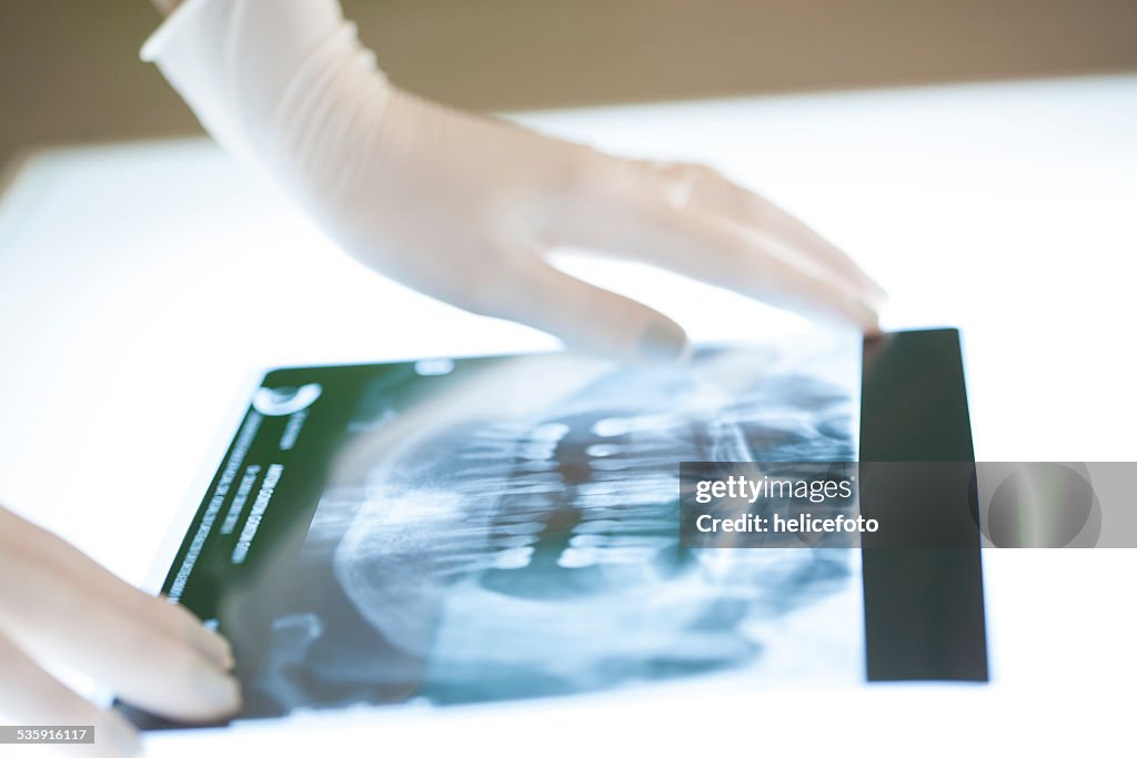 Cheking Imagem de raios x dental
